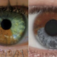 Image for article titled A Doctor Claims That He Can Magically Transform Brown Eyes to Blue with Lasers